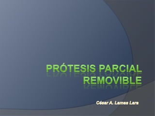 Prótesis Parcial Removible César A. Lamas Lara 