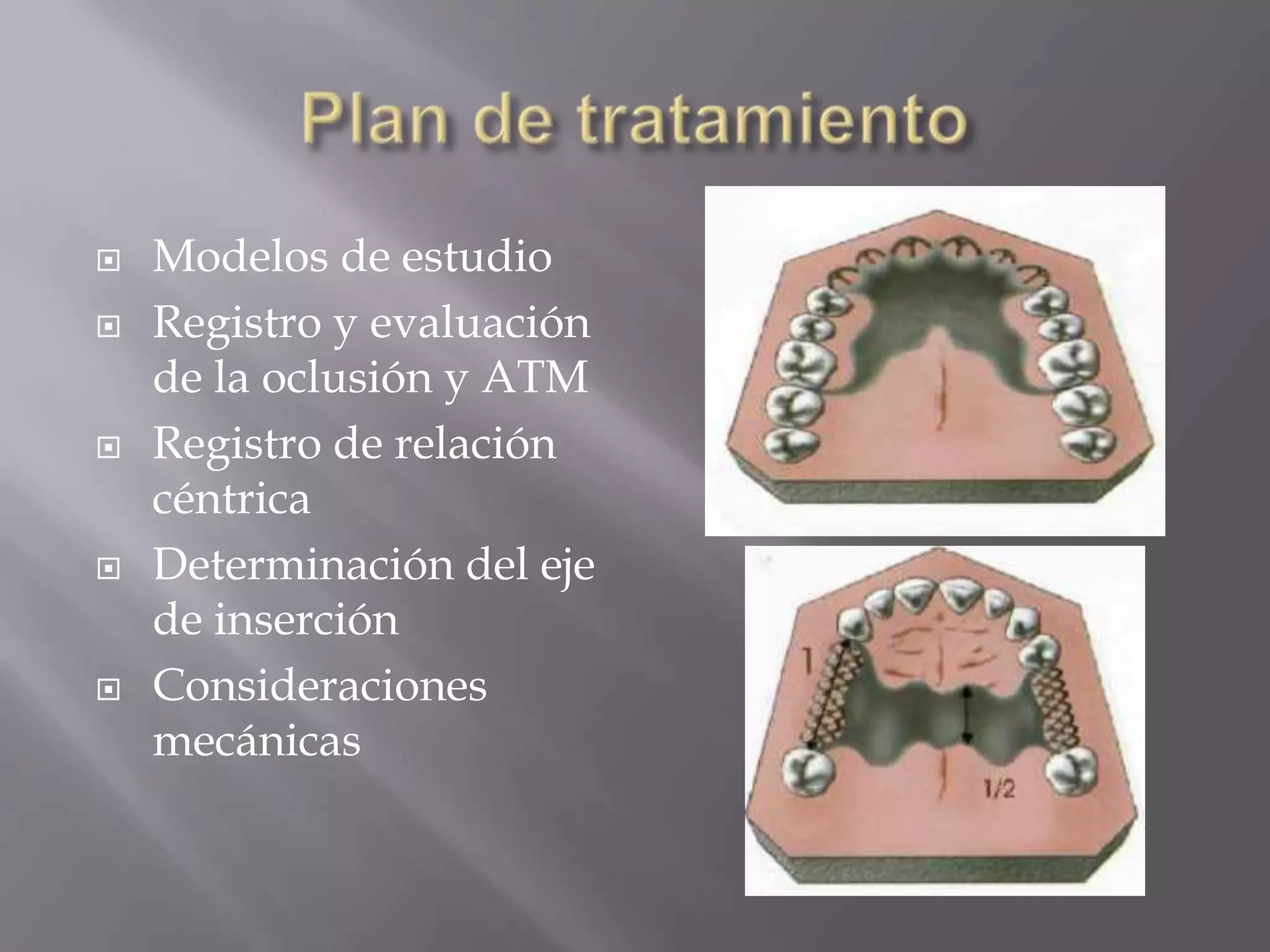 Prótesis parcial removible clasificacion de kennedy | PPTX | Dental ...