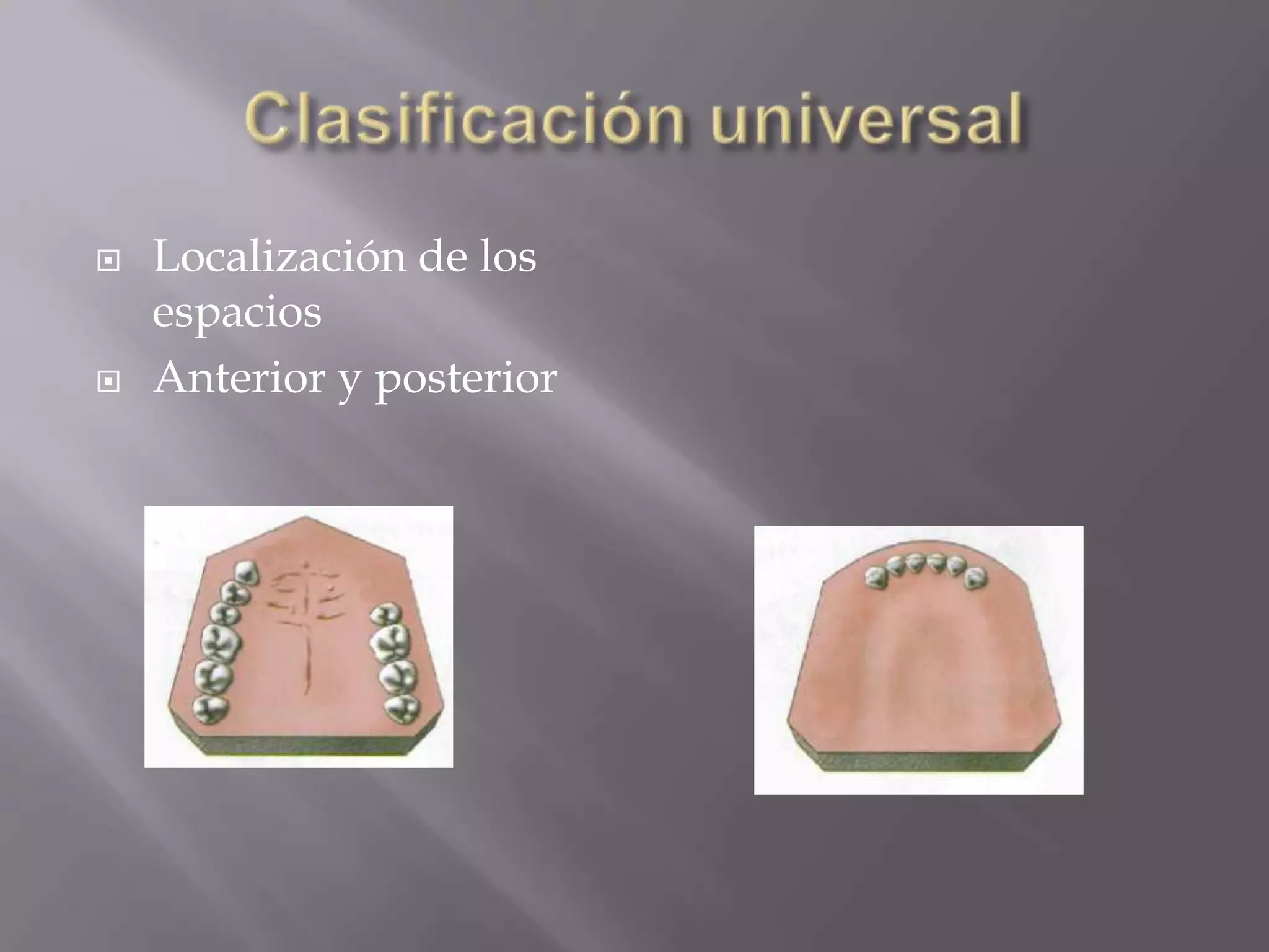 Prótesis parcial removible clasificacion de kennedy | PPTX | Dental ...