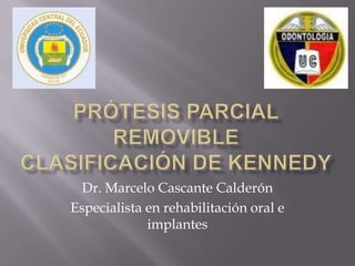 Dr. Marcelo Cascante Calderón
Especialista en rehabilitación oral e
implantes
 