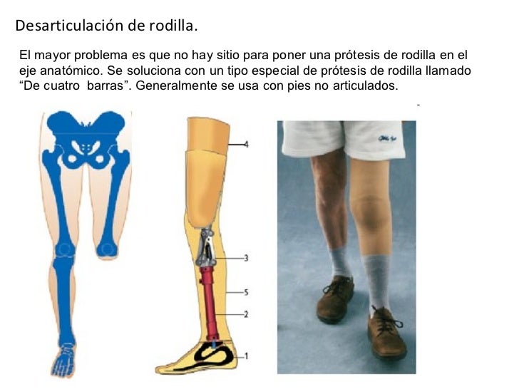 Más eficaz lifting la crema de la persona