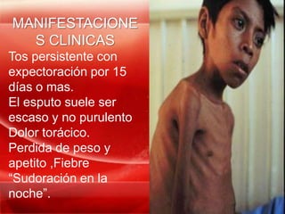 MANIFESTACIONE
  S CLINICAS
Tos persistente con
expectoración por 15
días o mas.
El esputo suele ser
escaso y no purulento
Dolor torácico.
Perdida de peso y
apetito ,Fiebre
“Sudoración en la
noche”.
 