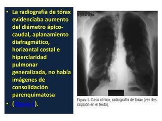 • La radiografía de tórax
evidenciaba aumento
del diámetro ápico-
caudal, aplanamiento
diafragmático,
horizontal costal e
hiperclaridad
pulmonar
generalizada, no había
imágenes de
consolidación
parenquimatosa
• (Figura 1).
 
