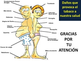 Daños que
provoca el
tabaco a
nuestra salud
GRACIAS
POR
TU
ATENCIÓN
 