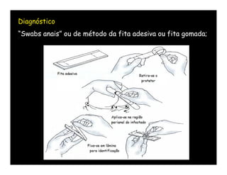 Diagnóstico
“Swabs anais” ou de método da fita adesiva ou fita gomada;
 
