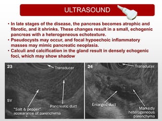 • In late stages of the disease, the pancreas becomes atrophic and
fibrotic, and it shrinks. These changes result in a small, echogenic
pancreas with a heterogeneous echotexture.
• Pseudocysts may occur, and focal hypoechoic inflammatory
masses may mimic pancreatic neoplasia.
• Calculi and calcification in the gland result in densely echogenic
foci, which may show shadow
ULTRASOUND
 
