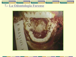 7.-  La Odontología Forense   