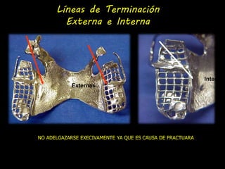 Líneas de Terminación 
Externa e Interna 
Externas 
Interna 
NO ADELGAZARSE EXECIVAMENTE YA QUE ES CAUSA DE FRACTUARA 
 