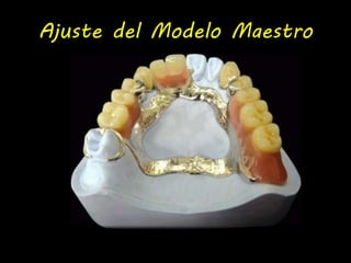 Ajuste del Modelo Maestro 
 