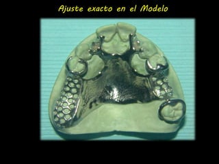 Ajuste exacto en el Modelo 
 