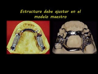 Estructura debe ajustar en el 
modelo maestro 
 
