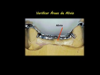 Verificar Áreas de Alivio 
Alivio 
 