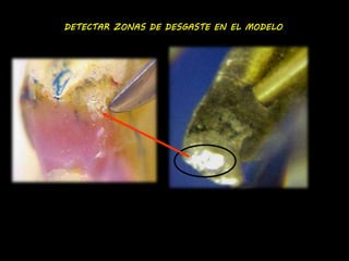 DETECTAR ZONAS DE DESGASTE EN EL MODELO 
 