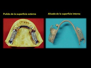 Pulido de la superficie externa Alisado de la superficie interna 
 