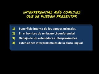 INTERFERENCIAS MÁS COMUNES 
QUE SE PUEDEN PRESENTAR 
1) Superficie interna de los apoyos oclusales 
2) En el hombro de un brazo circunferencial 
3) Debajo de los retenedores interproximales 
4) Extensiones interproximales de la placa lingual 
 