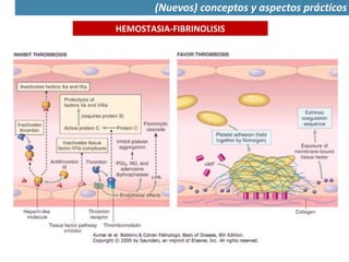 HEMOSTASIA-FIBRINOLISIS
(Nuevos) conceptos y aspectos prácticos
 