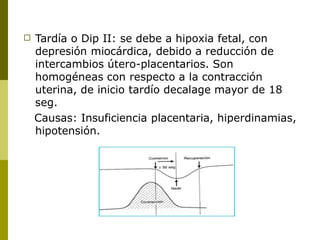□ Tardía o Dip II: se debe a hipoxia fetal, con
depresión miocárdica, debido a reducción de
intercambios útero-placentario...