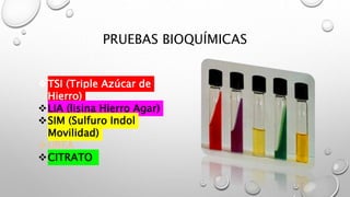 PRUEBAS BIOQUÍMICAS
TSI (Triple Azúcar de
Hierro)
LIA (lisina Hierro Agar)
SIM (Sulfuro Indol
Movilidad)
UREA
CITRATO
 