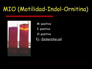 MIO (Motilidad-Indol-Ornitina)
M: positiva
I: positivo
O: positivo
Ej.: Escherichia coli
 