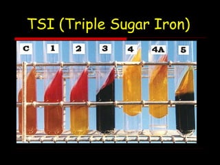 TSI (Triple Sugar Iron)
 