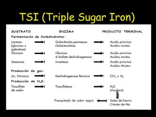 TSI (Triple Sugar Iron)
 