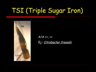 TSI (Triple Sugar Iron)
A/A ++, ++
Ej.: Citrobacter freundii
 