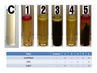 Tubo Control 1 2 3 4 5
motilidad - + - - + +
H2S - - - + - +
Indol - + - - - +
 