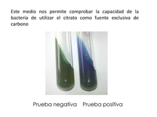 Este medio nos permite comprobar la capacidad de la
bacteria de utilizar el citrato como fuente exclusiva de
carbono
 