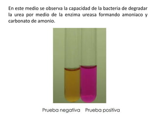 En este medio se observa la capacidad de la bacteria de degradar
la urea por medio de la enzima ureasa formando amoniaco y
carbonato de amonio.
 