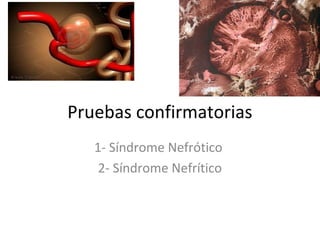 Pruebas confirmatorias
   1- Síndrome Nefrótico
    2- Síndrome Nefrítico
 