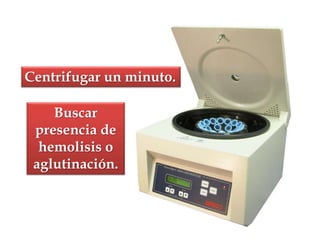 Centrifugar un minuto.
Buscar
presencia de
hemolisis o
aglutinación.
 