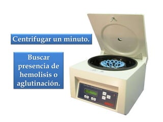 Centrifugar un minuto.
Buscar
presencia de
hemolisis o
aglutinación.
 