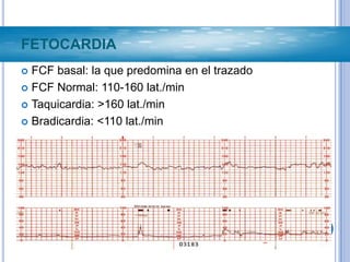 Pruebas de bienestar fetal | PPTX