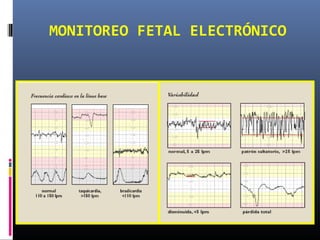 MONITOREO FETAL ELECTRÓNICO
 