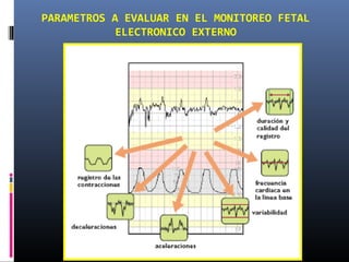 PARAMETROS A EVALUAR EN EL MONITOREO FETAL
ELECTRONICO EXTERNO
 