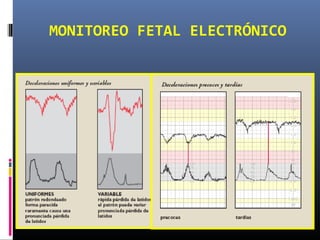 MONITOREO FETAL ELECTRÓNICO
 