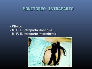 MONITOREO INTRAPARTOMONITOREO INTRAPARTO
- Clínico- Clínico
- M. F. E. Intraparto Contínuo- M. F. E. Intraparto Contínuo
- M. F. E. Intraparto Intermitente- M. F. E. Intraparto Intermitente
 