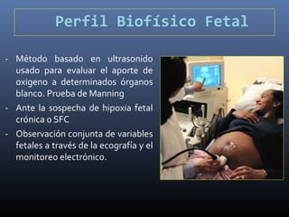 Perfil Biofísico Fetal
- Método basado en ultrasonido
usado para evaluar el aporte de
oxigeno a determinados órganos
blanco. Prueba de Manning
- Ante la sospecha de hipoxia fetal
crónica o SFC
- Observación conjunta de variables
fetales a través de la ecografía y el
monitoreo electrónico.
 