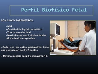 Perfil Biofísico Fetal
SON CINCO PARÁMETROS:SON CINCO PARÁMETROS:
- NST- NST
- Cantidad de líquido amniótico- Cantidad de líquido amniótico
- Tono muscular fetal- Tono muscular fetal
- Movimientos respiratorios fetales- Movimientos respiratorios fetales
-Movimientos corporales.Movimientos corporales.
-- Cada uno de estos parámetros tieneCada uno de estos parámetros tiene
una puntuación de 0 y 2 puntosuna puntuación de 0 y 2 puntos
- Mínimo puntaje será 0 y el máximo 10.- Mínimo puntaje será 0 y el máximo 10.
 