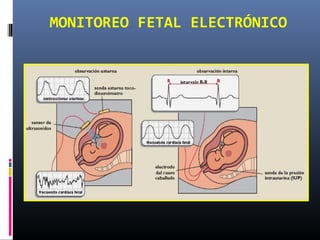 MONITOREO FETAL ELECTRÓNICO
 
