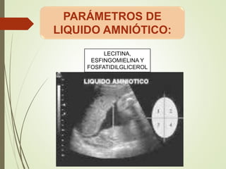 LECITINA,
ESFINGOMIELINA Y
FOSFATIDILGLICEROL
..
PARÁMETROS DE
LIQUIDO AMNIÓTICO:
 