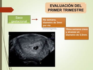 Saco
gestacional
EVALUACIÓN DEL
PRIMER TRIMESTRE
 