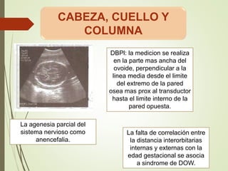 DBPl: la medicion se realiza
en la parte mas ancha del
ovoide, perpendicular a la
linea media desde el limite
del extremo de la pared
osea mas prox al transductor
hasta el limite interno de la
pared opuesta.
La agenesia parcial del
sistema nervioso como
anencefalia.
La falta de correlación entre
la distancia interorbitarias
internas y externas con la
edad gestacional se asocia
a sindrome de DOW.
CABEZA, CUELLO Y
COLUMNA
 