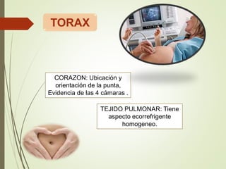 CORAZON: Ubicación y
orientación de la punta,
Evidencia de las 4 cámaras .
TEJIDO PULMONAR: Tiene
aspecto ecorrefrigente
homogeneo.
TORAX
 