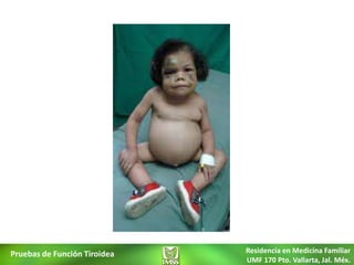 Pruebas de Función Tiroidea   Residencia en Medicina Familiar
                              UMF 170 Pto. Vallarta, Jal. Méx.
 
