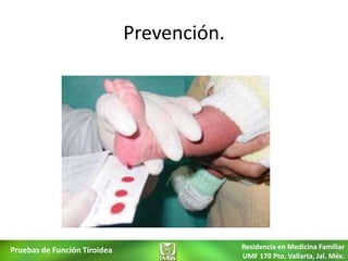 Prevención.




Pruebas de Función Tiroidea                 Residencia en Medicina Familiar
                                            UMF 170 Pto. Vallarta, Jal. Méx.
 