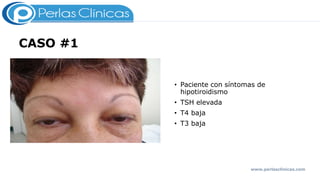 CASO #1
• Paciente con síntomas de
hipotiroidismo
• TSH elevada
• T4 baja
• T3 baja
www.perlasclinicas.com
 