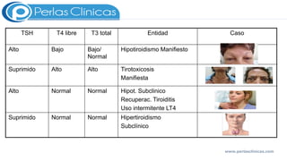 TSH T4 libre T3 total Entidad Caso
Alto Bajo Bajo/
Normal
Hipotiroidismo Manifiesto
Suprimido Alto Alto Tirotoxicosis
Manifiesta
Alto Normal Normal Hipot. Subclinico
Recuperac. Tiroiditis
Uso intermitente LT4
Suprimido Normal Normal Hipertiroidismo
Subclínico
www.perlasclinicas.com
 