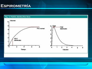 Espirometría
 