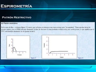 Espirometría

Patrón Restrictivo
 